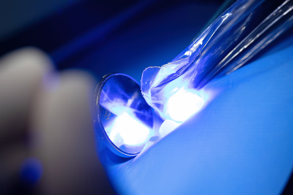 Dental Bonding: An Effective Way To Improve Your Smile