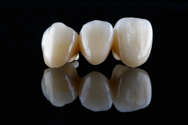 How A Dental Bridge Addresses Gaps